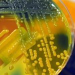 “Nightmare Bacteria” Widespread in U.S. Hospitals